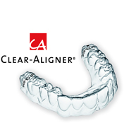 clear-aligner_11.jpg