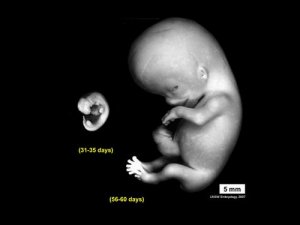 embryo_human_004.JPG