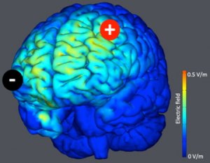 cerveau.jpg