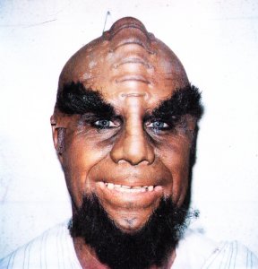 Early_Klingon_with_teeth.jpg