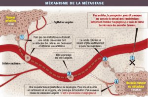 metastase.jpg